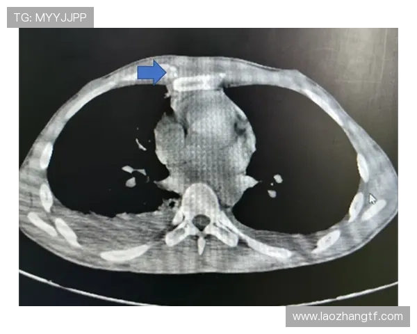 伊斯科坦言软骨伤难以完全康复